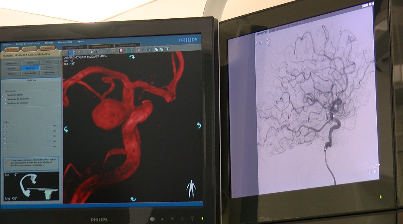 Nueva clínica especializada en frecuencia cardiaca
