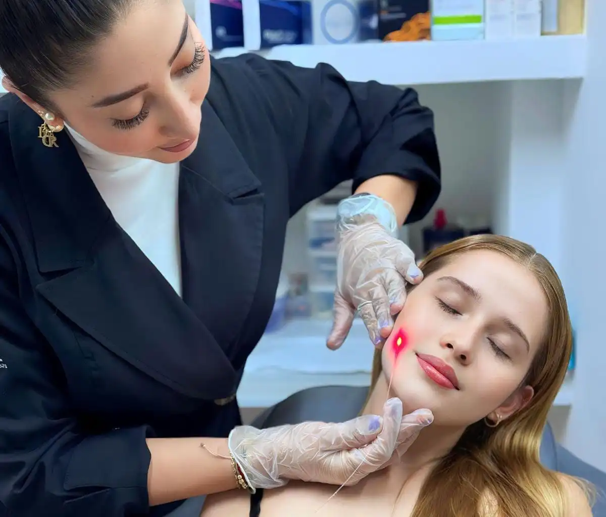 Optimizando la juventud cutánea en Arte Corporal: Descubre el Endolifting