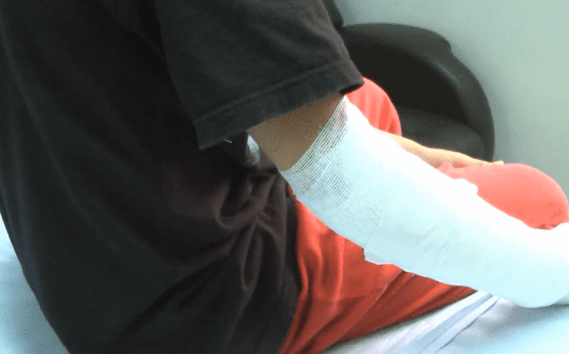 Recomendaciones para prevenir accidentes y quemaduras en diciembre